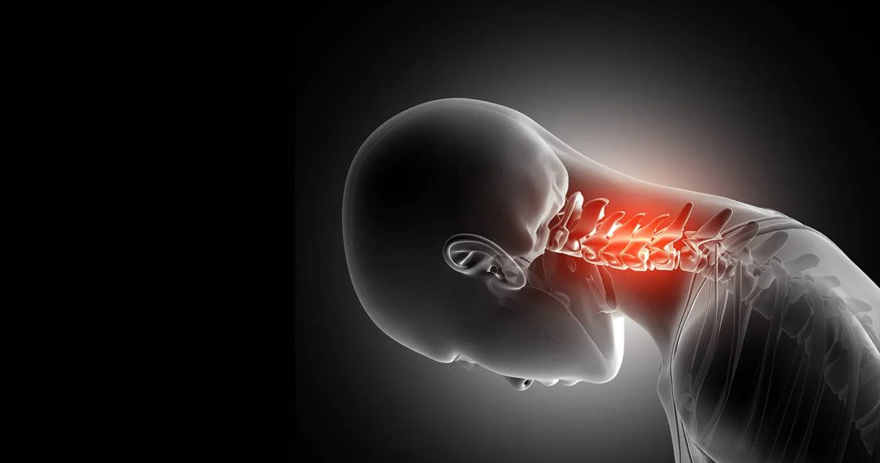 Coluna travada - Região Cervical