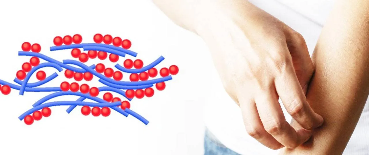 7 alergias na pele causadas pelas doenças do glúten