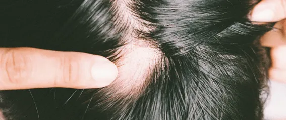 Dados sobre doença celíaca em crianças