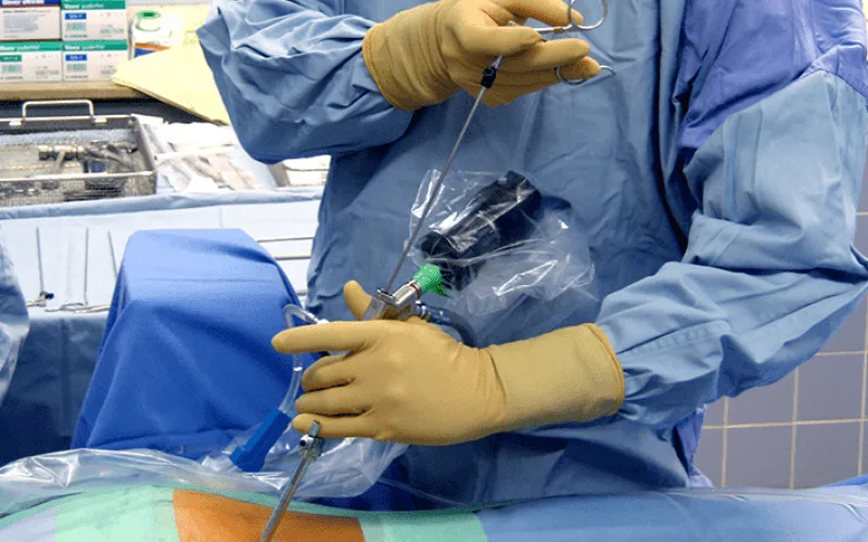 Endoscopia da coluna