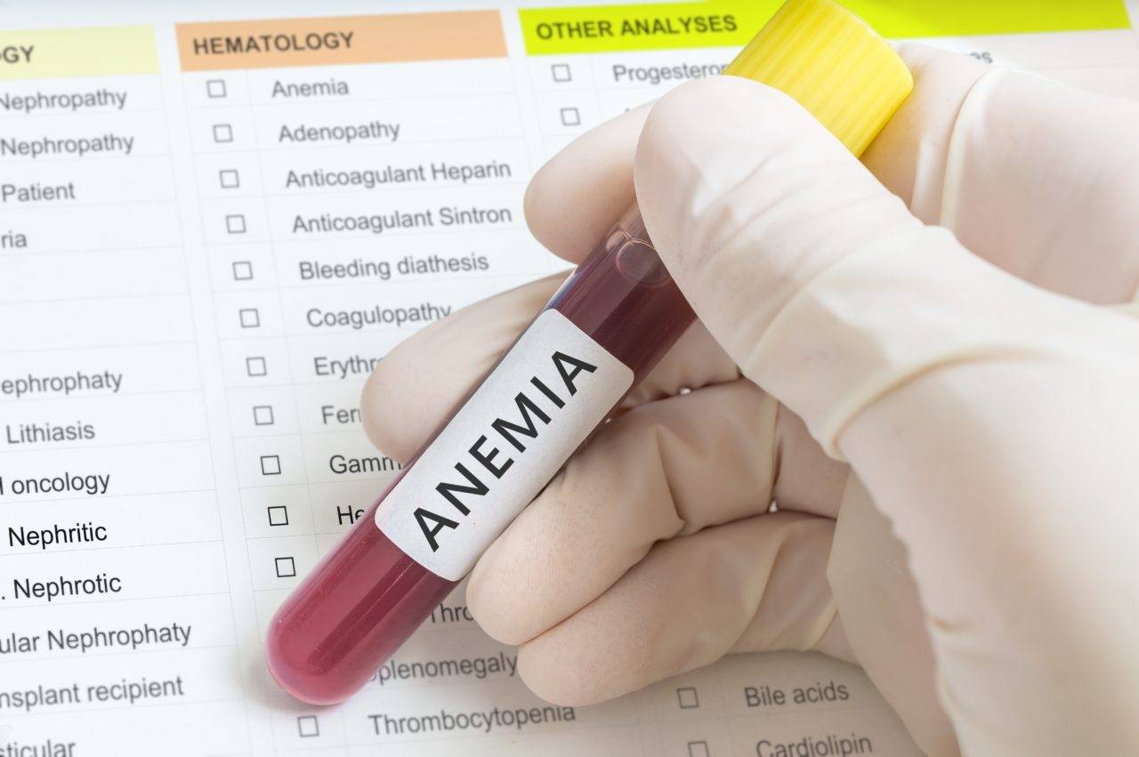 anemia-perniciosa-metformina